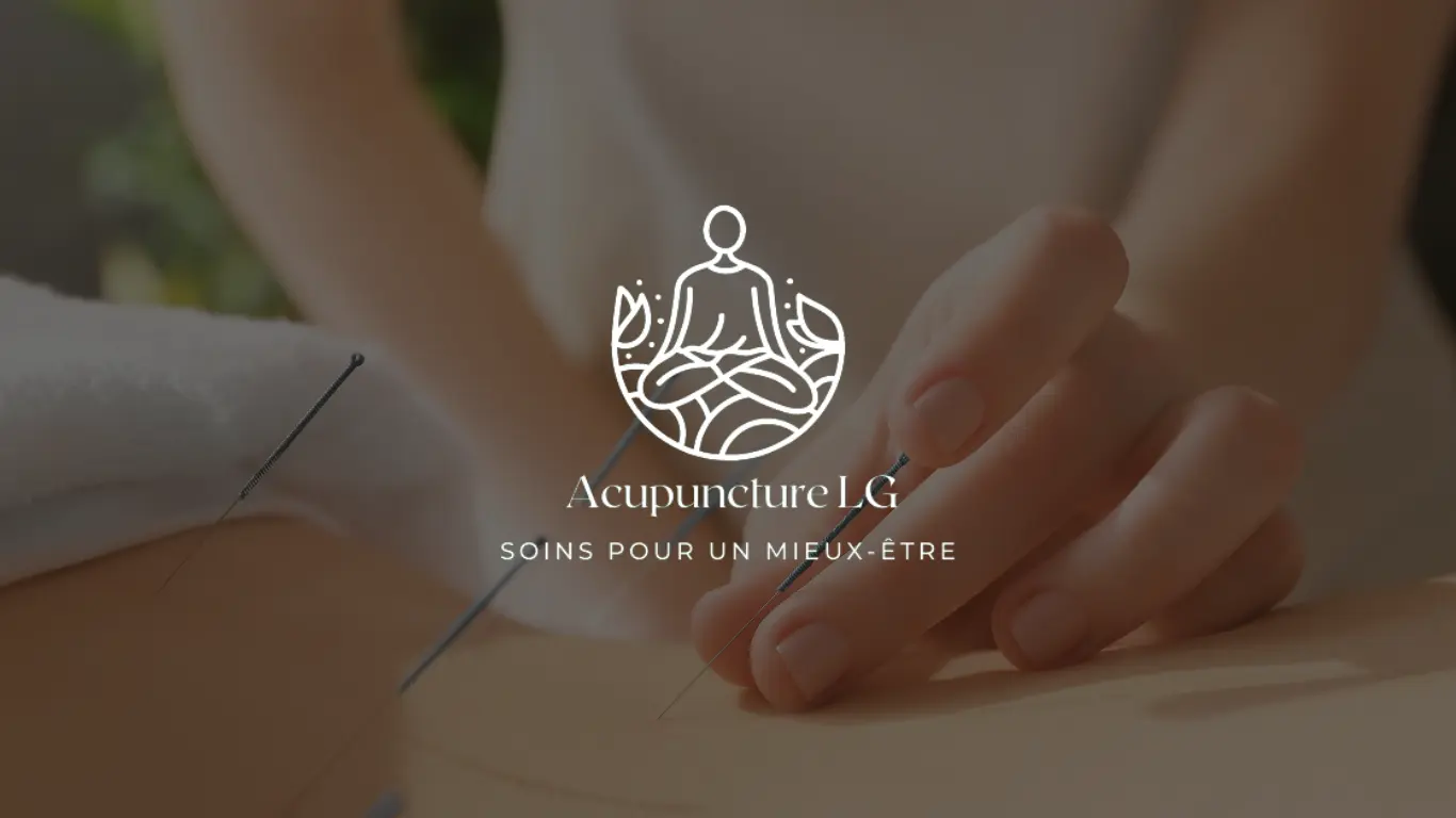 Conception web et optimisation de la page pour les moteurs de recherche (SEO) pour acupuncture